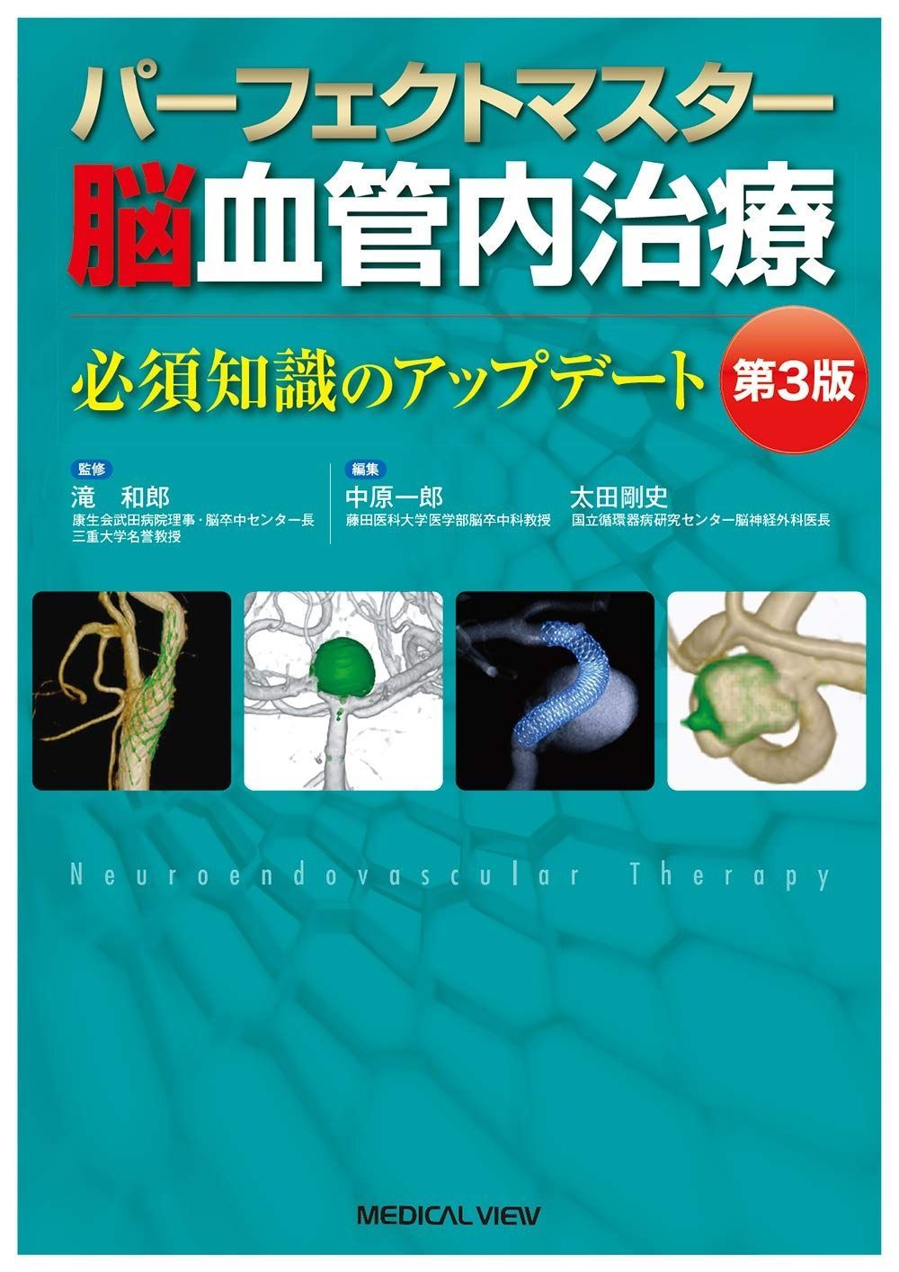 パーフェクトマスター脳血管内治療?第3版