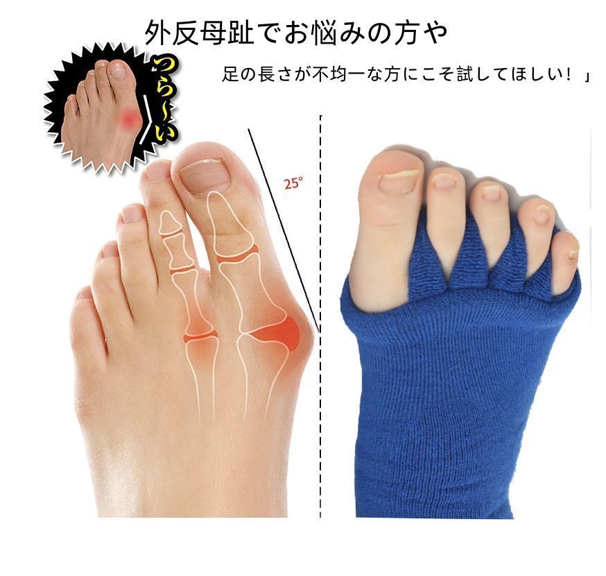 母趾サポーター　3セット 外反母趾サポーター セラピーソ ックス 3足セット 6個入り 内反