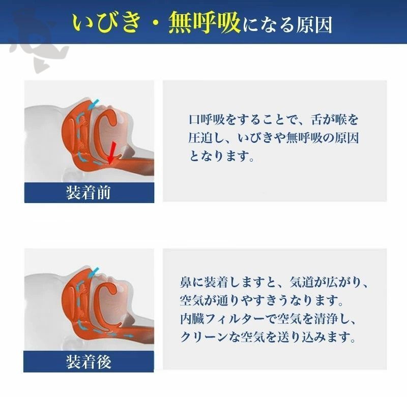 いびき防止 グッズ 睡眠改善グッズ USB充電式 いびき対策 呼吸対策 鼻呼吸促進 安眠グッズ 落下防止 疲れ取る 空気清浄機 鼾防止 鼻呼吸サポート  呼吸補助 鼻拡張器 抗いびき 鼻プラグ 簡単装着 - メルカリ