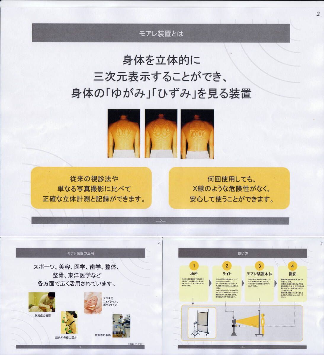 新リンパ療法モアレ画像診断一式