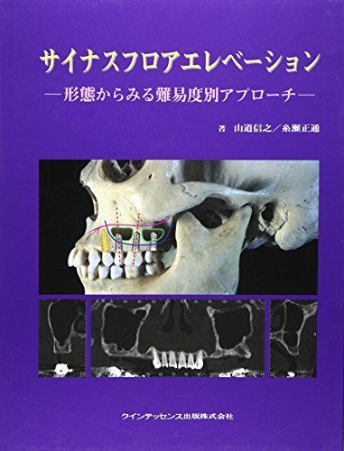  サイナスフロアエレベーション-形態からみる難易度別アプローチ [単行本] 山道信之; 糸瀬正通 語学・辞書・学習参考書