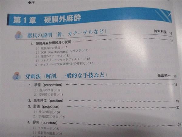 羊土社 硬膜外麻酔・脊髄麻酔 視覚と感覚で確実に施行する基本とコツ 2009 009s3D 羊土社 硬膜外麻酔・脊髄麻酔 視覚と感覚で確実に施行する基本と
