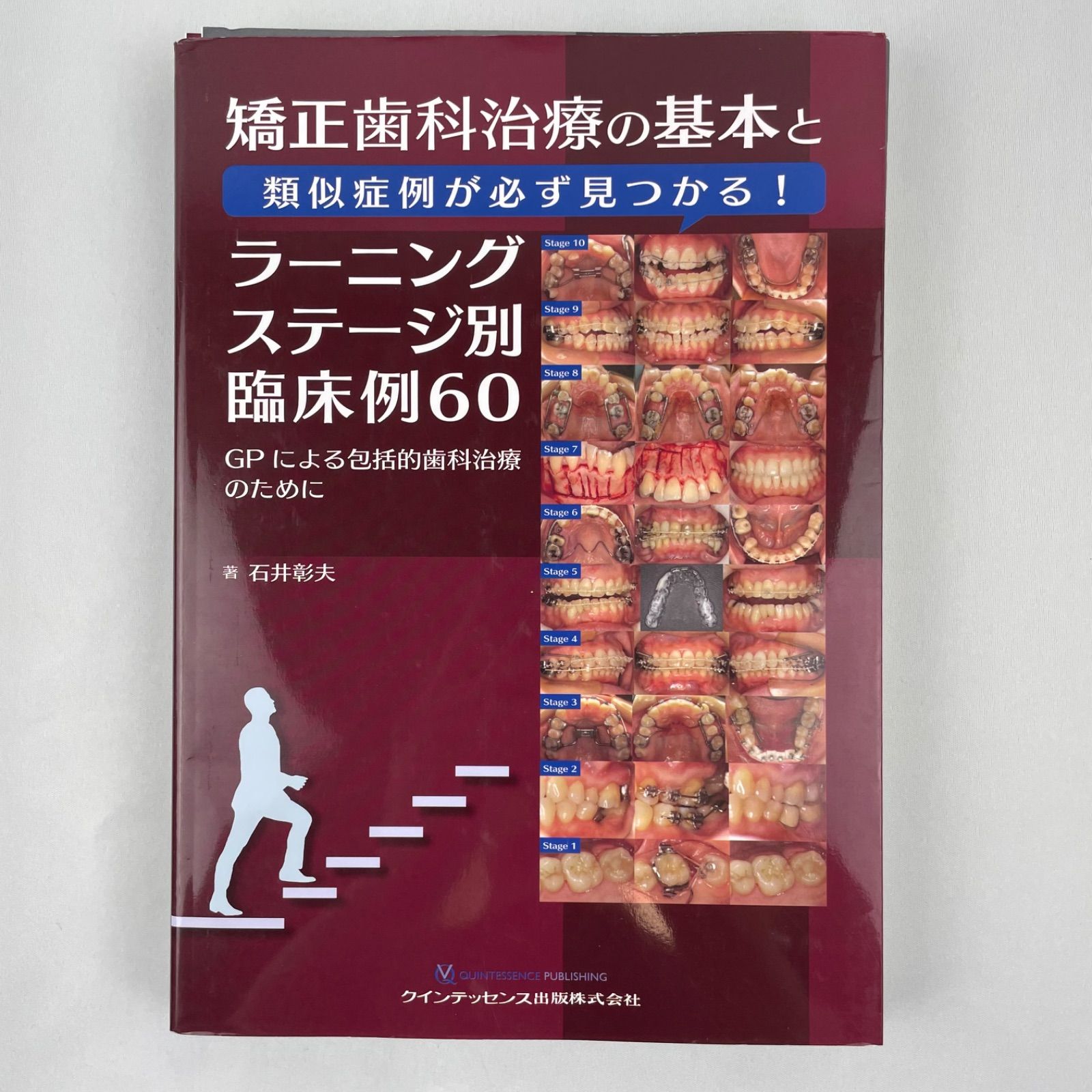 裁断済 矯正歯科治療の基本と類似症例が必ず見つかる!ラーニングステージ別臨床60