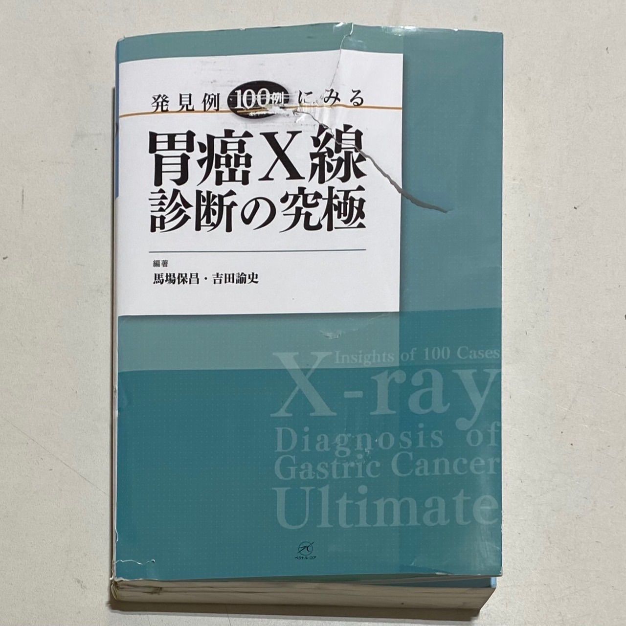 発見例100例にみる胃癌X線診断の究極 発見例100例にみる胃癌X線診断の究極 - メルカリ