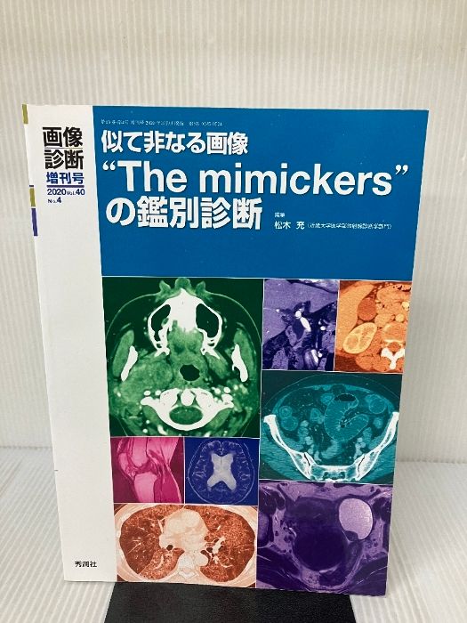 画像診断2020年増刊号(Vol.40 No.4) 似て非なる画像“The