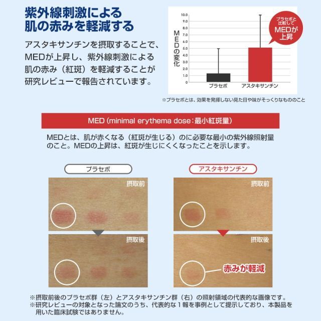肌うるる