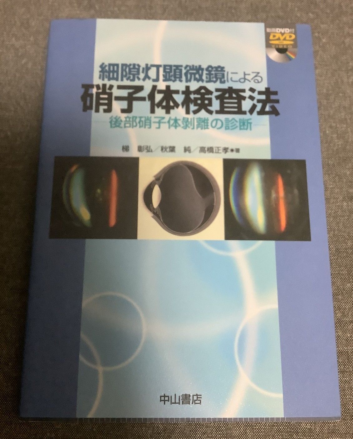 細隙灯顕微鏡による硝子体検査法 後部硝子体剥離の診断 梯 細隙灯顕微鏡による硝子体検査法 後部硝子体剥離の診断 梯