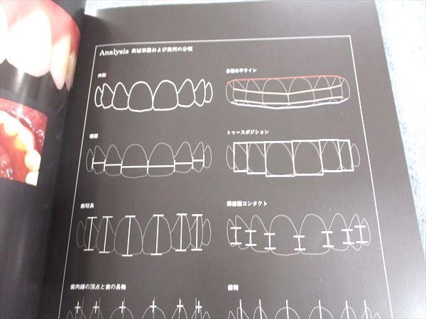 XC04-052 医歯薬出版 月刊 歯科技工 別冊 審美歯科治療のための天然歯フォトギャラリー 2009 12S3D - メルカリ