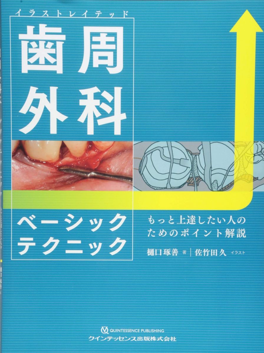 イラストレイテッド 歯周外科ベーシックテクニック