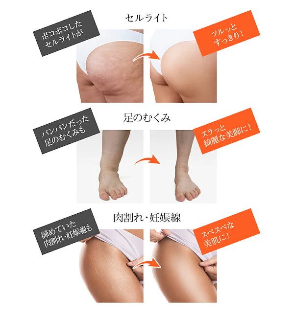 ヒートリテイン ボディースタイリングホットジェル 200g2個　正規品 ヒートリテイン ボディースタイリングホットジェル 200g2個 正規