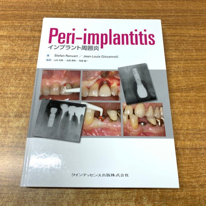 ▲01)【同梱不可】Peri-implantitis インプラント周囲炎/Stefan Renvert/Jean-Louis Giovannoli/クインテッセンス出版/2013年発行/A △01)【同梱不可】Peri-implantitis インプラント周囲炎/Stefan