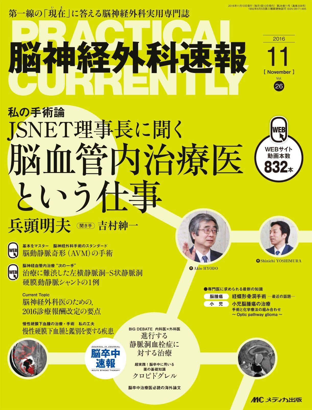 脳神経外科速報 2016年11月号(第26巻11号)特集:JSNET 理事長に聞く 脳血管内治療医という仕事
