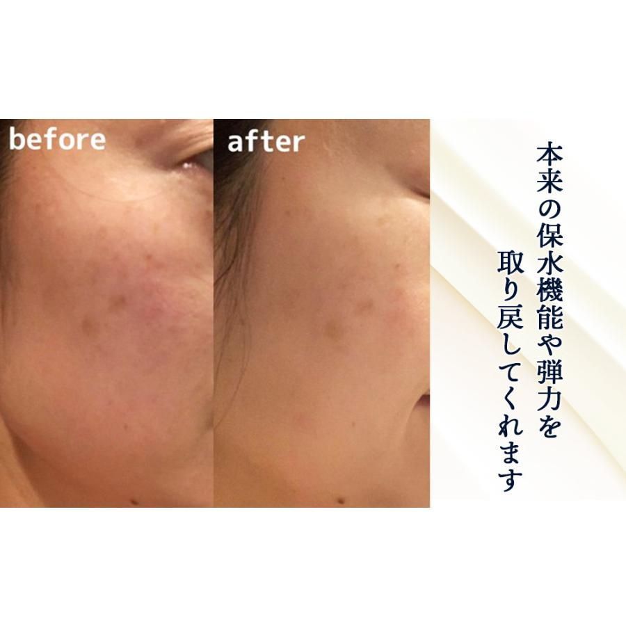 ＼3本セットで★20%OFF ／生プラセンタ アヨロのピリカ 1本30ml　2本セット 保湿 ターンオーバー エイジング くすみ 毛穴 角質ケア 無添加 国産 セラム 美容液 生プラセンタ 2本セット アヨロのピリカ 1本30ml 保湿 ターンオーバー