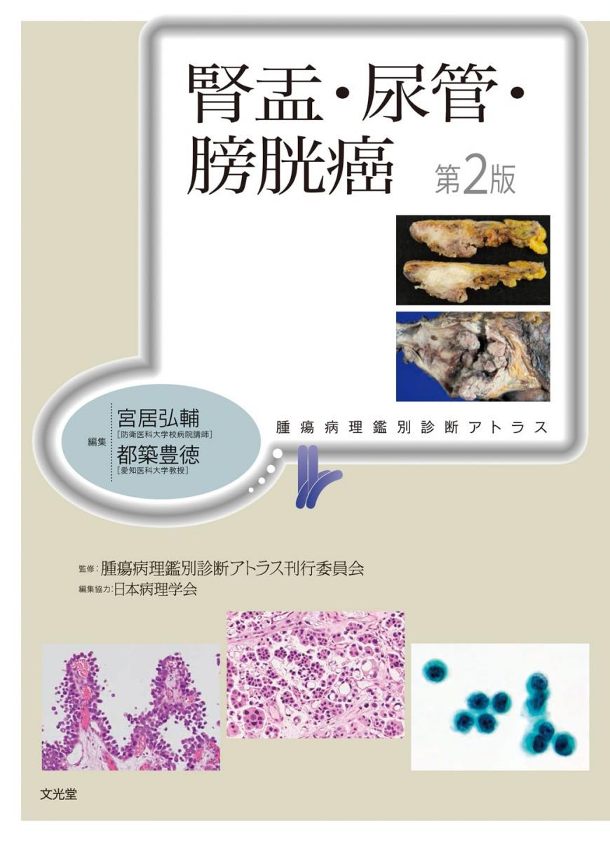 腎盂 尿管 膀胱癌 第2版 腫瘍病理鑑別診断アトラス