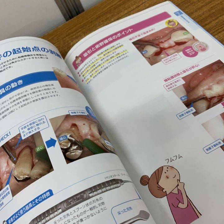 ベーシック GBR クインテッセンス出版　インプラント　歯科 改訂新版 歯科インプラント治療ガイドブック - クインテッセンス出版