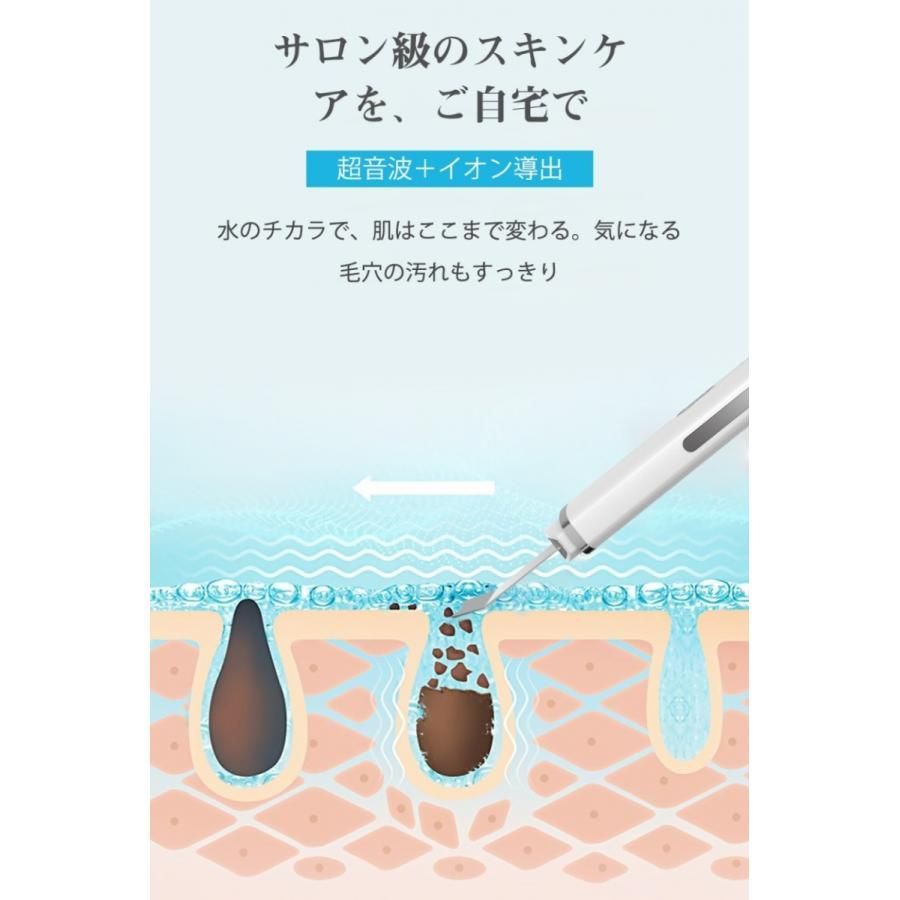 超音波美顔器　スマートピール 楽天市場】ME スマートピールネオ ☆最大3,000円クーポン