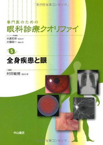 全身疾患と眼 (専門医のための眼科診療クオリファイ) [単行本