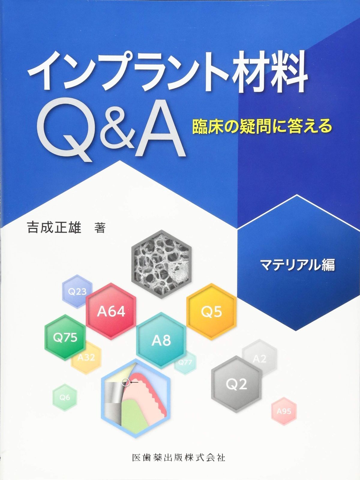 インプラント材料Q-A 臨床の疑問に答える マテリアル編
