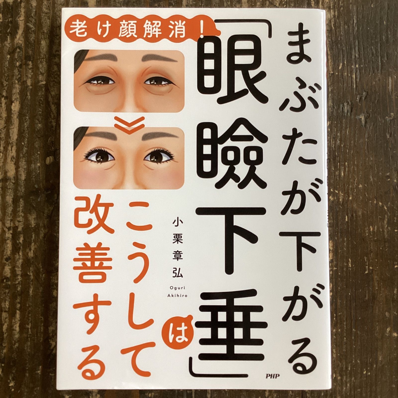 まぶたが下がる眼瞼下垂 こうして改善する - 健康