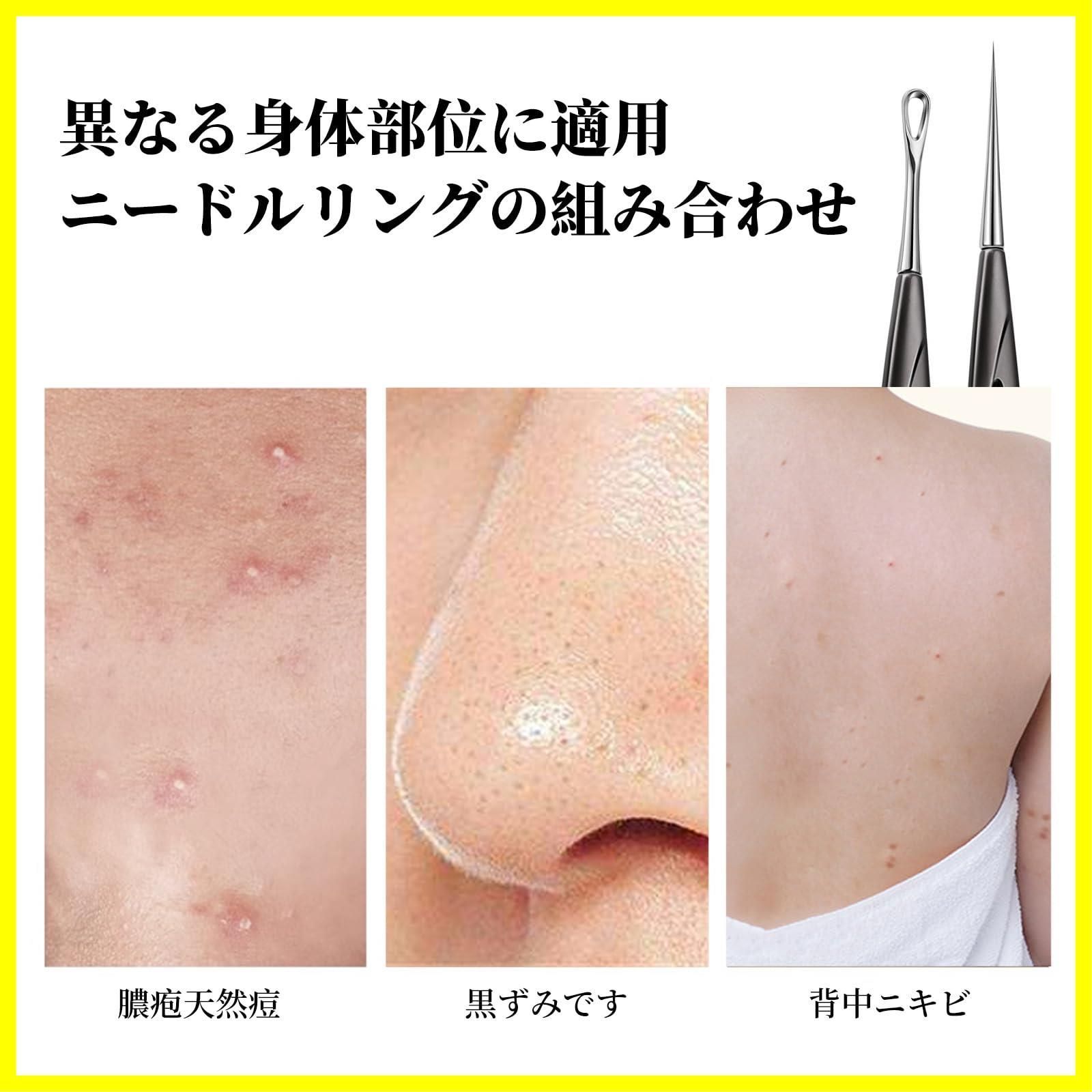 早い者勝ち】針 【2本セット】角栓取りニキビ ニキビ 取り 器具