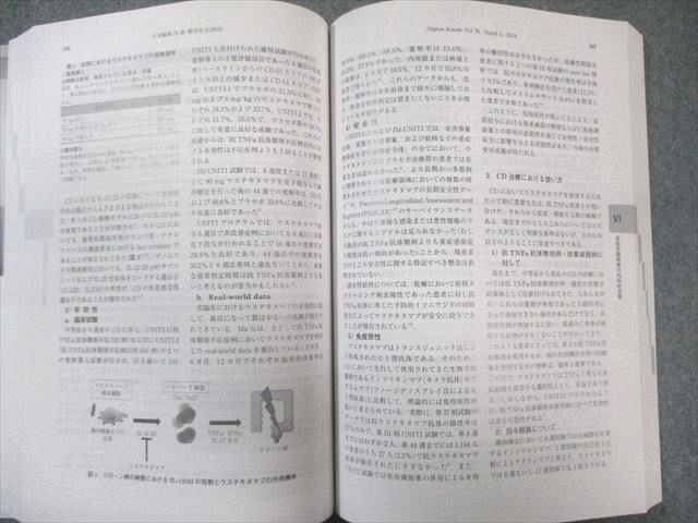 日本臨牀社 炎症性腸疾患(第2版) 増刊号 2018 024M3D 潰瘍性