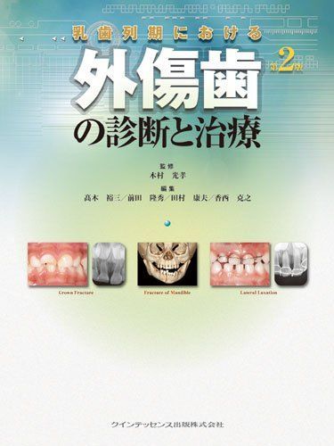 外傷歯の診断と治療 Amazon.co.jp: 外傷歯の診断と治療 増補新版 (シリーズ MIに