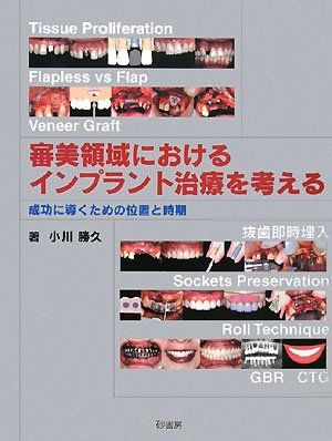 審美領域におけるインプラント治療を考える―成功に導くための位置と時期 小川 勝久 審美領域におけるインプラント治療を考える―成功に導くための