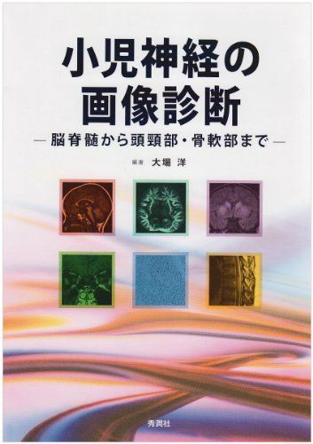 小児神経の画像診断: 脳脊髄から頭頸部・骨軟部まで 大場 洋