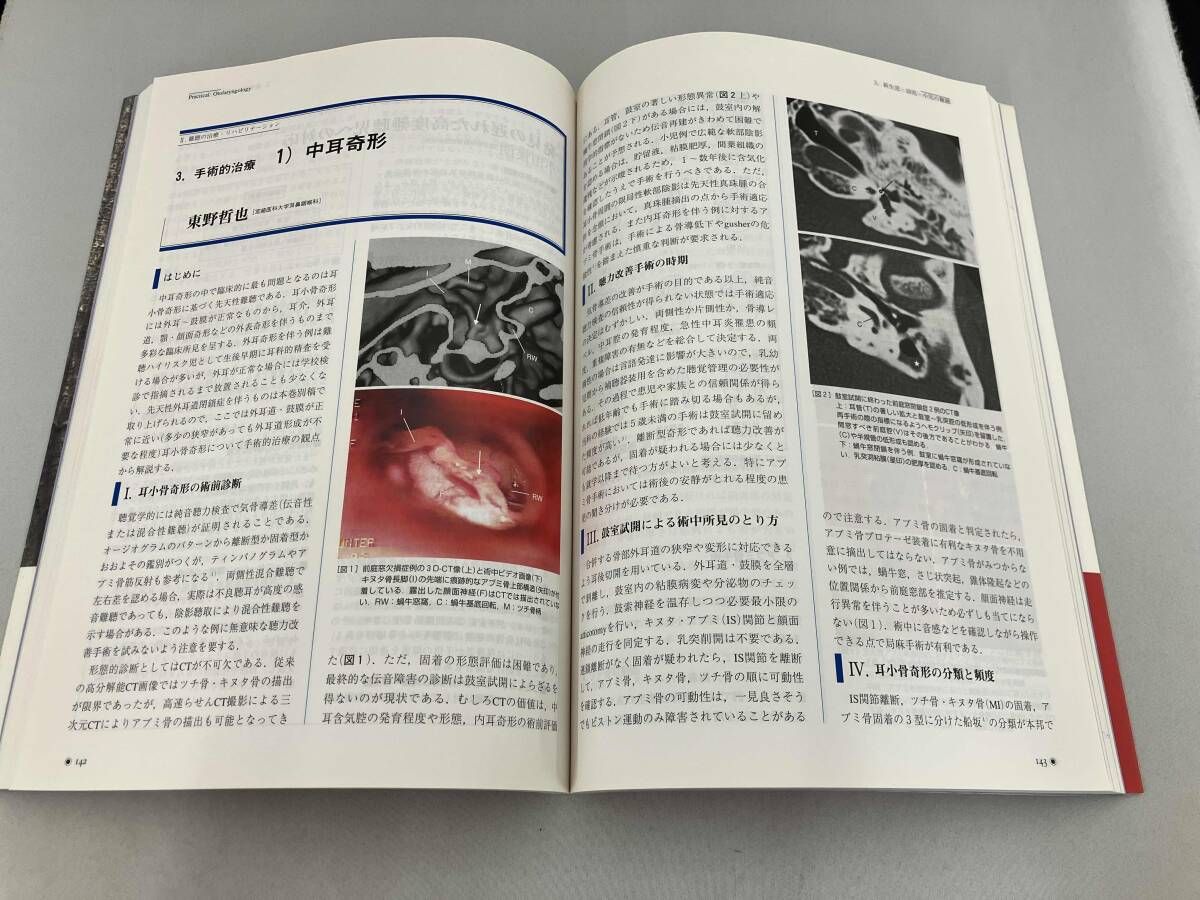 耳鼻咽喉科　診療プラクティス(３) 新生児・幼児・小児の難聴 耳鼻咽喉科診療プラクティス３／加我君孝(編者) 耳鼻咽喉科 診療プラクティス(3) 加我君孝 - メルカリ
