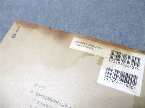 文光堂 専門医のための呼吸器外科の要点と盲点 II 2010 土屋了介