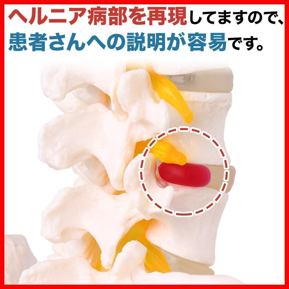 台座付きせき髄 脊柱模型