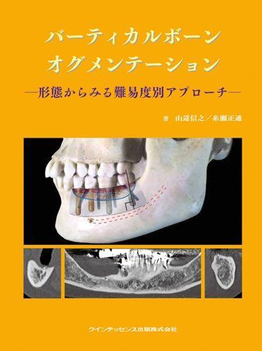 バーティカルボーンオグメンテーション