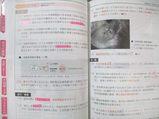 メディックメディア CBT・医師国家試験のためのレビューブック 産婦人科 2022ｰ2023 020m3D CBT・医師国家試験のためのレビューブック マイナー 2022