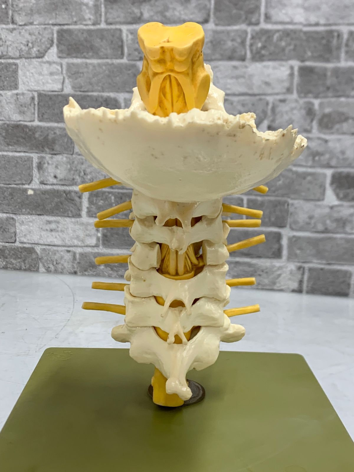 SOMSO ソムソ社 ベスト 人体模型 頸椎模型 SOMSO(ソムソ)社製 脊柱模型