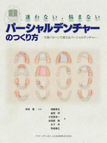 迷わない 悩まない パーシャルデンチャーのつくり方 Quint kick-off library