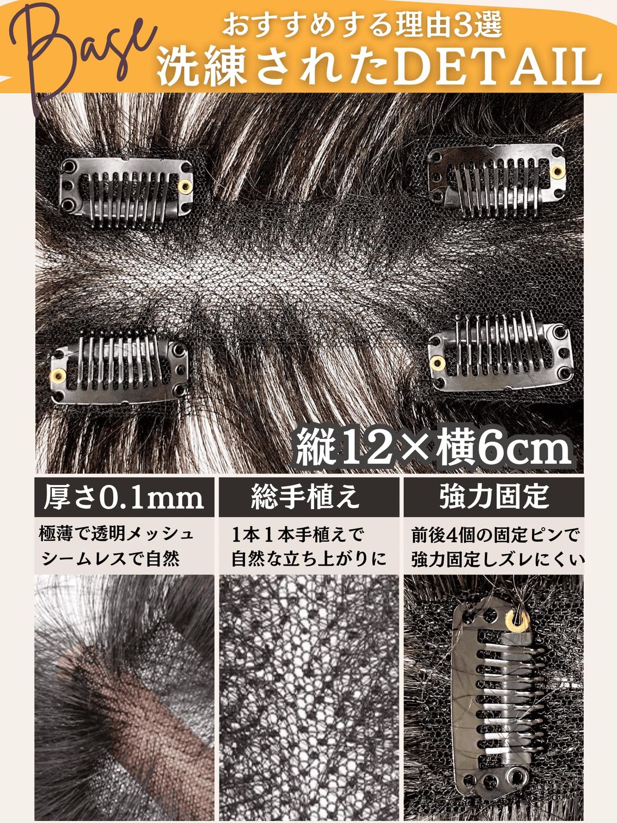 頭頂部