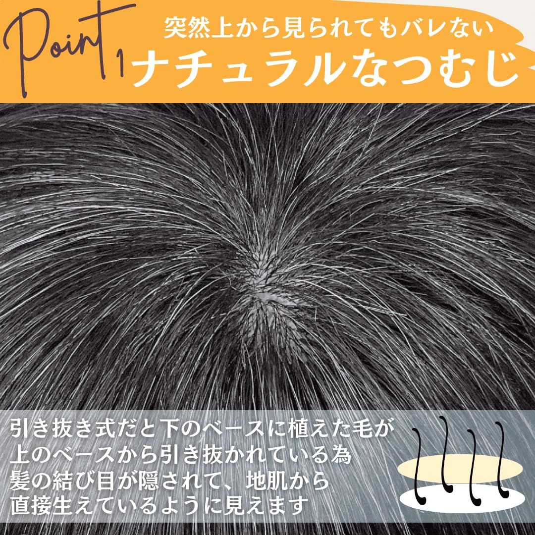 トップピース