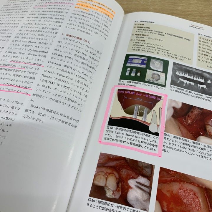 ●01 同梱不可 Perfect sinus lift 上顎洞底挙上術のすべて|小林文夫|高橋常男|ゼニス出版|2010年|歯科学|A