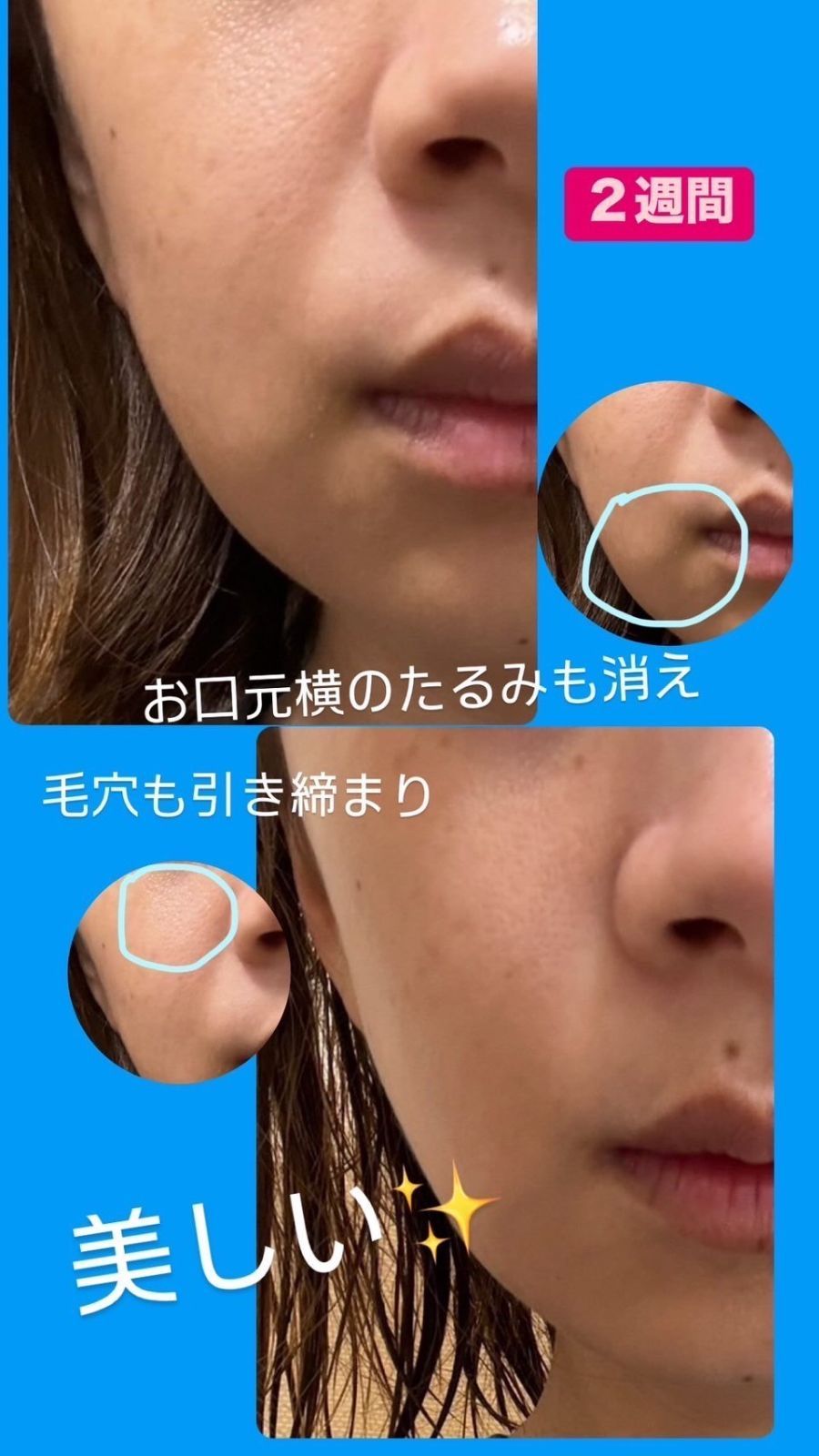 AKINORIO New ミトコンドリアのちから◇アキノリオ◇正規代理店