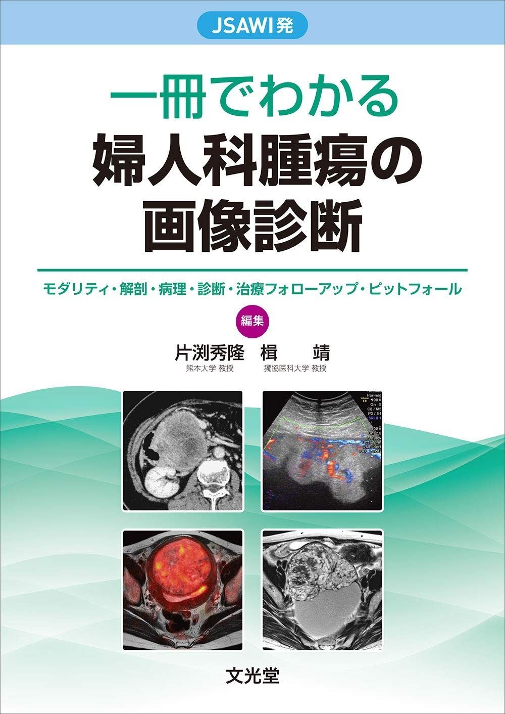 JSAWI発 一冊でわかる婦人科腫瘍の画像診断