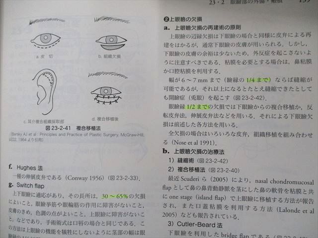 UP81-008 南江堂 形成外科手術書【改訂第4版】 基礎編・実際編 2007