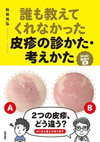 誰も教えてくれなかった皮疹の診かた・考えかた[Web動画付]