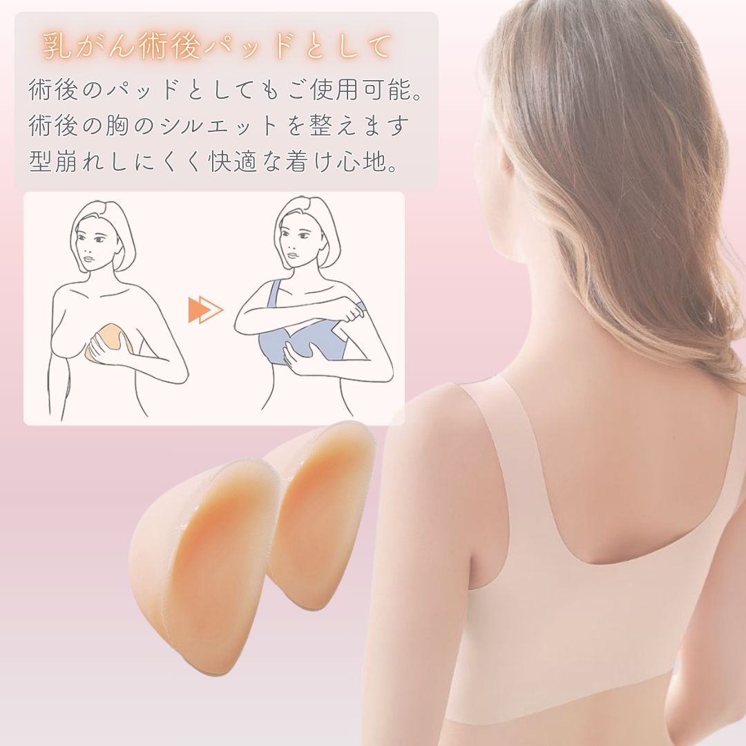 シリコンバスト 人工乳房