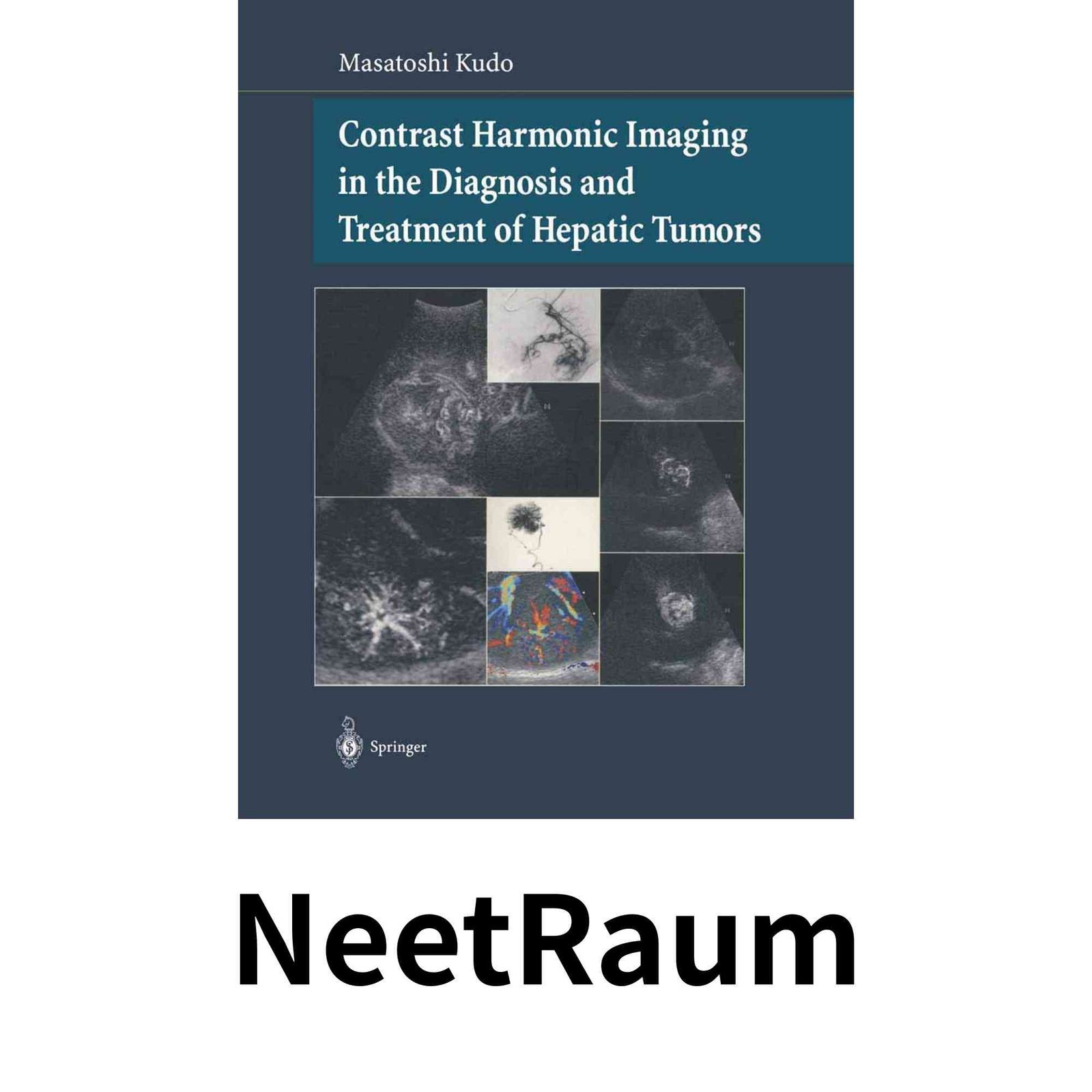 Contrast Harmonic Imaging in the Diagnosis and Treatment of Hepatic Tumors Kudo Masatoshi