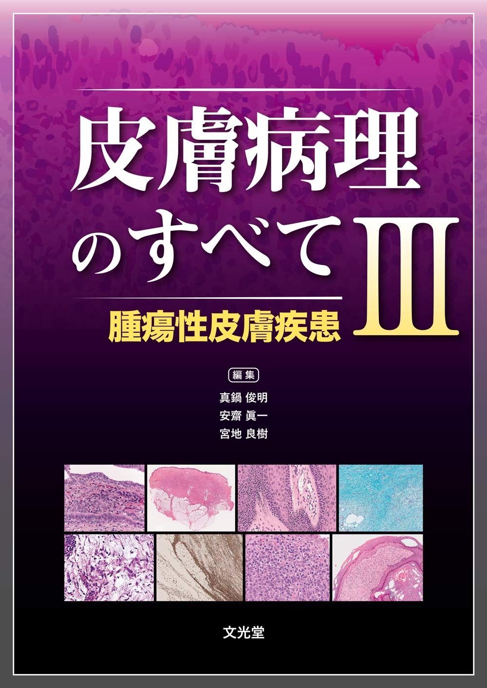 皮膚病理のすべて III 腫瘍性皮膚疾患