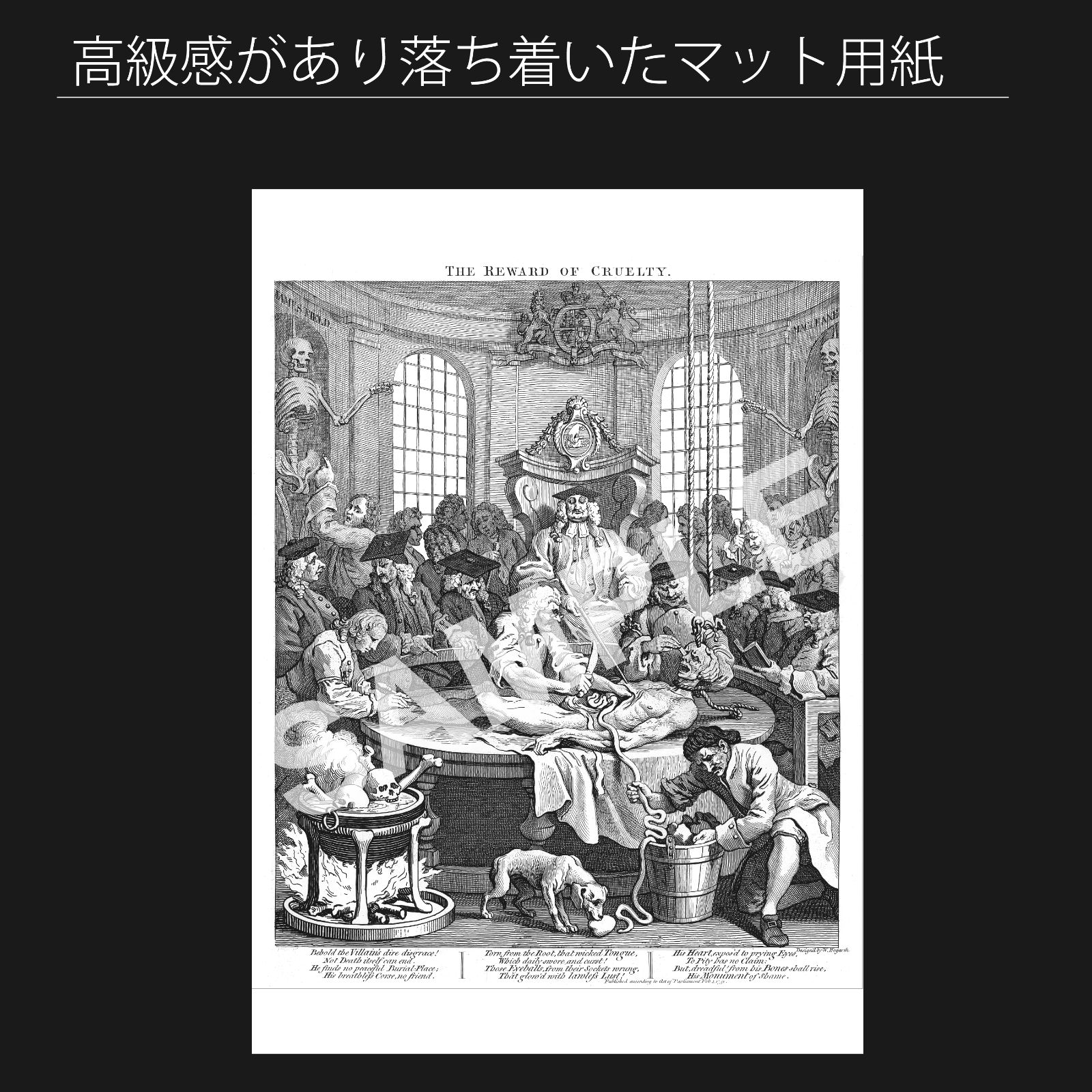 ウィリアム ホガース William Hogarth 残酷さの報酬 処刑された男の断面図 1751年 アートポスターA2 マット紙 フレーム付 IN