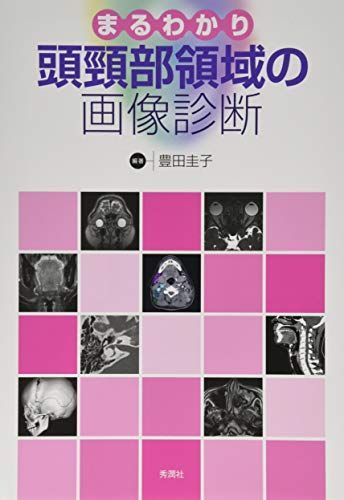 まるわかり頭頸部領域の画像診断 [単行本] 豊田 圭子