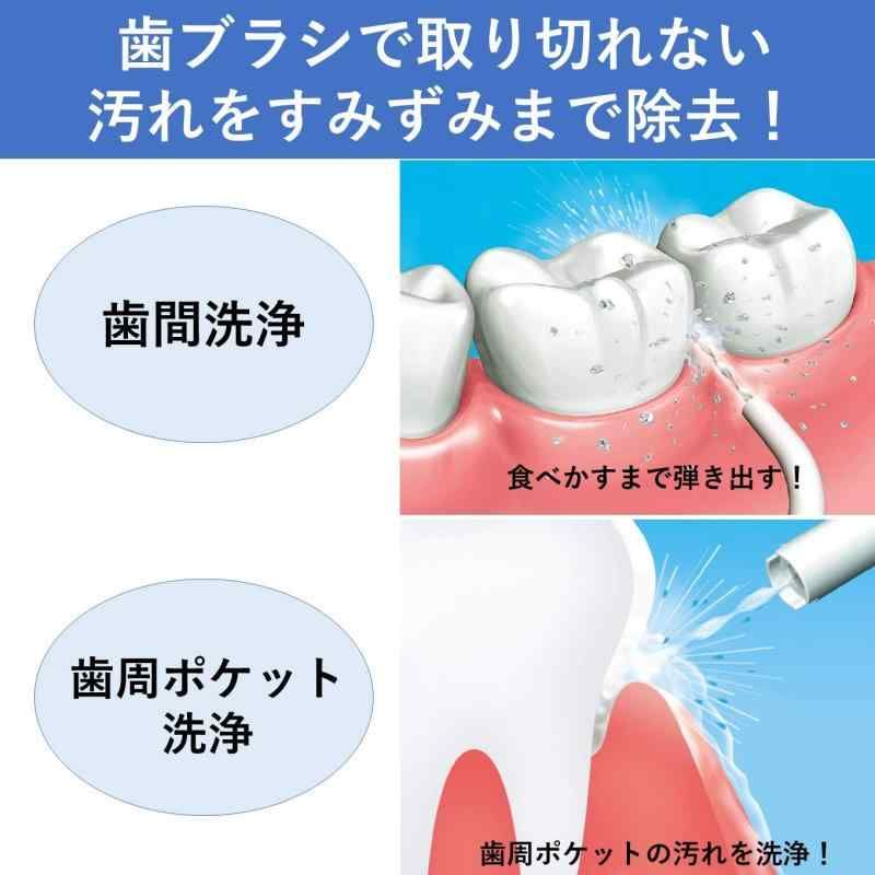 口腔洗浄器 ジェットウォッシャー