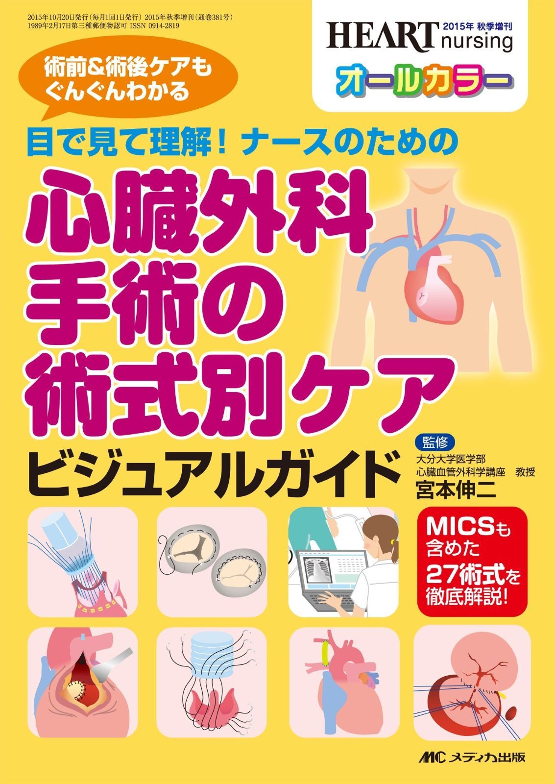 心臓外科手術の術式別ケア ビジュアルガイド 目で見て理解! | ナースの