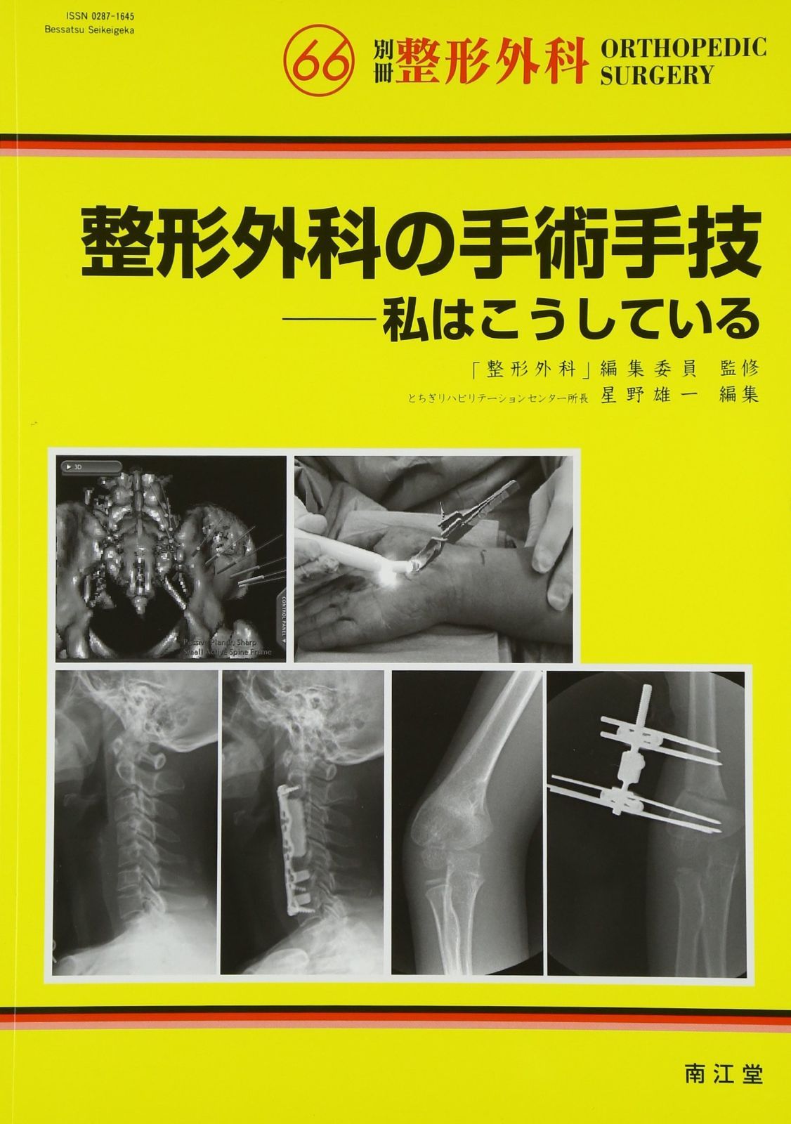 整形外科の手術手技: 私はこうしている (別冊整形外科 no.66)